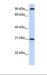 ANKRA2 / ANKRA Antibody - Hela cell lysate. Antibody concentration: 1.0 ug/ml. Gel concentration: 12%.  This image was taken for the unconjugated form of this product. Other forms have not been tested.