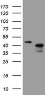 ANKRA2 / ANKRA Antibody - HEK293T cells were transfected with the pCMV6-ENTRY control (Left lane) or pCMV6-ENTRY ANKRA2 (Right lane) cDNA for 48 hrs and lysed. Equivalent amounts of cell lysates (5 ug per lane) were separated by SDS-PAGE and immunoblotted with anti-ANKRA2 (1:2000).