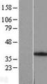 ANKRA2 / ANKRA Protein - Western validation with an anti-DDK antibody * L: Control HEK293 lysate R: Over-expression lysate