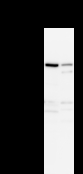 ANKRD11 Antibody - Detection of ANKRD11 by Western blot. Samples: Whole cell lysate from human A2058 (H, 50 ug) and mouse NIH3T3 (M, 50 ug) cells. Predicted molecular weight: 297 kDa