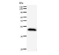 ANKRD11 Antibody - Western blot analysis of immunized recombinant protein, using anti-ANKRD11 monoclonal antibody.
