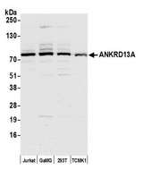 ANKRD13A Antibody - Detection of human and mouse ANKRD13A by western blot. Samples: Whole cell lysate (15 µg) from Jurkat, GaMG, HEK293T, and TCMK-1 cells prepared using NETN lysis buffer. Antibody: Affinity purified Rabbit anti-ANKRD13A antibody used for WB at 1:1000. Secondary: HRP-conjugated goat anti-rabbit IgG (A120-101P). Chemiluminescence with an exposure time of 30 seconds.