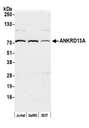 ANKRD13A Antibody - Detection of human ANKRD13A by western blot. Samples: Whole cell lysate (50 µg) from Jurkat, GaMG, and HEK293T cells prepared using NETN lysis buffer. Antibody: Affinity purified Rabbit anti-ANKRD13A antibody used for WB at 1:1000. Detection: Chemiluminescence with an exposure time of 75 seconds.