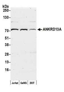 ANKRD13A Antibody - Detection of human ANKRD13A by western blot. Samples: Whole cell lysate (50 µg) from Jurkat, GaMG, and HEK293T cells prepared using NETN lysis buffer. Antibody: Affinity purified Rabbit anti-ANKRD13A antibody used for WB at 1:1000. Detection: Chemiluminescence with an exposure time of 75 seconds.