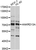 ANKRD13A Antibody - Western blot analysis of extracts of various cell lines, using ANKRD13A antibody at 1:1000 dilution. The secondary antibody used was an HRP Goat Anti-Rabbit IgG (H+L) at 1:10000 dilution. Lysates were loaded 25ug per lane and 3% nonfat dry milk in TBST was used for blocking. An ECL Kit was used for detection and the exposure time was 10s.