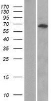 ANKRD13A Protein - Western validation with an anti-DDK antibody * L: Control HEK293 lysate R: Over-expression lysate