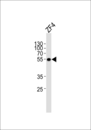 ANKRD13C Antibody - Western blot of lysate from ZF4 cell line with (DANRE) ankrd13c Antibody. Antibody was diluted at 1:1000. A goat anti-rabbit IgG H&L (HRP) at 1:5000 dilution was used as the secondary antibody. Lysate at 35 ug.