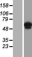 ANKRD13C Protein - Western validation with an anti-DDK antibody * L: Control HEK293 lysate R: Over-expression lysate