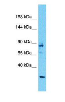 ANKRD17 Antibody - Western blot of ANKRD17 Antibody with human 293T Whole Cell lysate.  This image was taken for the unconjugated form of this product. Other forms have not been tested.