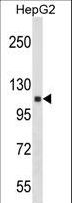 ANKRD18A Antibody - ANKRD18A Antibody western blot of HepG2 cell line lysates (35 ug/lane). The ANKRD18A antibody detected the ANKRD18A protein (arrow).