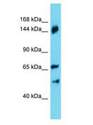 ANKRD18B Antibody - ANKRD18B antibody Western Blot of HepG2. Antibody dilution: 1 ug/ml.  This image was taken for the unconjugated form of this product. Other forms have not been tested.