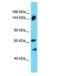 ANKRD18B Antibody - ANKRD18B antibody Western Blot of HepG2. Antibody dilution: 1 ug/ml.  This image was taken for the unconjugated form of this product. Other forms have not been tested.