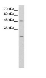 ANKRD2 Antibody - HepG2 Cell Lysate.  This image was taken for the unconjugated form of this product. Other forms have not been tested.