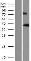ANKRD2 Protein - Western validation with an anti-DDK antibody * L: Control HEK293 lysate R: Over-expression lysate