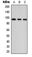 ANKRD20A1 Antibody - Western blot analysis of ANKRD20A1 expression in HeLa (A); NS-1 (B); PC12 (C) whole cell lysates.