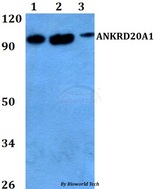 ANKRD20A1 Antibody - Western blot of ANKRD20A1 antibody at 1:500 dilution. Lane 1: HeLa whole cell lysate. Lane 2: sp2/0 whole cell lysate. Lane 3: PC12 whole cell lysate.