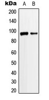 ANKRD20A3 Antibody - Western blot analysis of ANKRD20A3 expression in Jurkat (A); K562 (B) whole cell lysates.