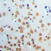 ANKRD20A3 Antibody - Immunohistochemical analysis of ANKRD20A3 staining in human brain formalin fixed paraffin embedded tissue section. The section was pre-treated using heat mediated antigen retrieval with sodium citrate buffer (pH 6.0). The section was then incubated with the antibody at room temperature and detected using an HRP conjugated compact polymer system. DAB was used as the chromogen. The section was then counterstained with hematoxylin and mounted with DPX.