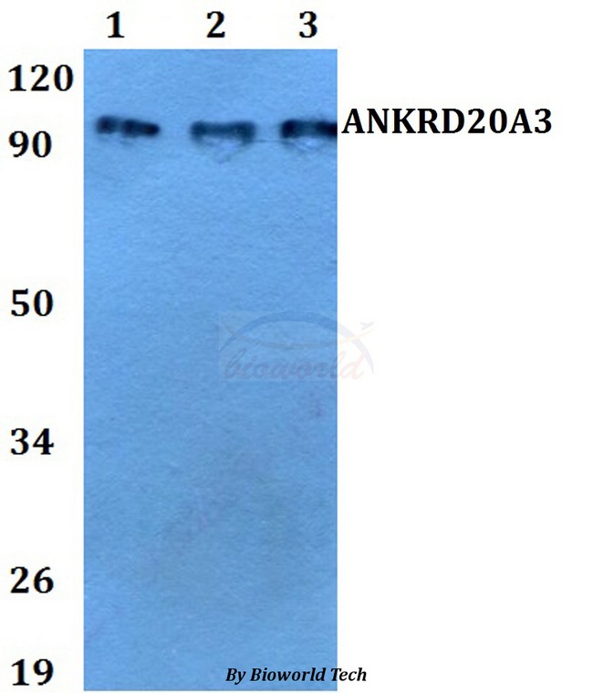 ANKRD20A3 Antibody - Western blot of ANKRD20A3 antibody at 1:500 dilution. Lane 1: MCF-7 whole cell lysate. Lane 2: sp2/0 whole cell lysate. Lane 3: PC12 whole cell lysate.