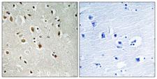 ANKRD20A3 Antibody - Peptide - + Immunohistochemistry analysis of paraffin-embedded human brain tissue using ANKRD20A3 antibody.