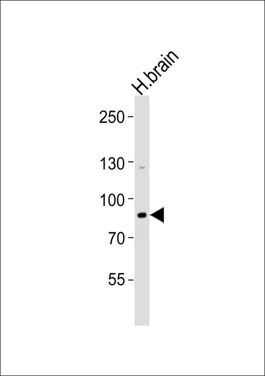 ANKRD20A8P Antibody - Western blot analysis of lysate from human brain tissue lysate, using ANKRD20A8P Antibody (Center). ANKRD20A8P Antibody (Center) was diluted at 1:1000. A goat anti-rabbit IgG H&L (HRP) at 1:5000 dilution was used as the secondary antibody. Lysate at 35ug.