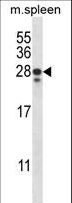 ANKRD22 Antibody - ANKRD22 Antibody western blot of mouse spleen tissue lysates (35 ug/lane). The ANKRD22 antibody detected the ANKRD22 protein (arrow).