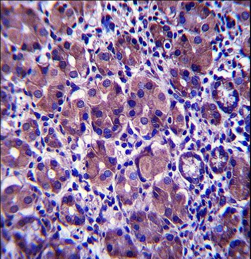 ANKRD22 Antibody - ANKRD22 Antibody immunohistochemistry of formalin-fixed and paraffin-embedded human stomach tissue followed by peroxidase-conjugated secondary antibody and DAB staining.