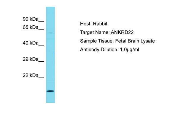 ANKRD22 Antibody -  This image was taken for the unconjugated form of this product. Other forms have not been tested.