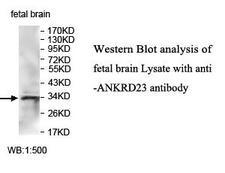 ANKRD23 / DARP Antibody