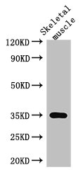 ANKRD23 / DARP Antibody - Western Blot Positive WB detected in: Mouse skeletal muscle tissue All lanes: ANKRD23 antibody at 2.5µg/ml Secondary Goat polyclonal to rabbit IgG at 1/50000 dilution Predicted band size: 35, 30 kDa Observed band size: 35 kDa