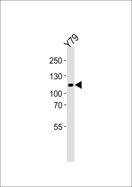 ANKRD24 Antibody - Western blot of lysate from Y79 cell line with ANKRD24 Antibody. Antibody was diluted at 1:1000. A goat anti-rabbit IgG H&L (HRP) at 1:5000 dilution was used as the secondary antibody. Lysate at 35 ug.
