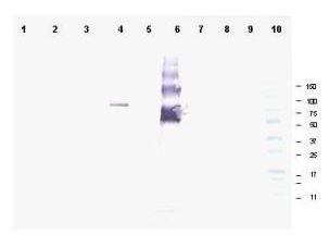 ANKRD26 Antibody - Anti-Ankrd26 Antibody - Western Blot. Western blot of affinity purified anti-Ankrd26 antibody shows detection of a band at ~81 kD corresponding to mouse Ankrd26 protein. Lane 1 Blank, Lane 2 MES cell lysate - 80 ug, Lane 3 MES cell lysate - 40 ug, Lane 4 293T-ANKRD26 transfected cell lysate - 20 ug, Lane 5 control 293T cell lysate - 20 ug, Lane 6 BSA-ANKRD26 conjugate 20 ng, Lane 7 BSA - 500 ng, Lane 8 BSA - 100 ng, Lane 9 BSA 20 ng and Lane 10 Protein standards. Detection of endogenous Ankrd26 protein in MES cell lysates may occur when detection methods with higher sensitivity are used. Proteins were separated by SDS-PAGE, transferred to nitrocellulose, and probed with the primary antibody diluted to 1:1000 followed by detection using ALP conjugated Gt-a-Rabbit IgG (LS-C60866 is suggested) diluted to 1:3000. Size estimation was made by comparison to prestained MW markers as indicated. Personal Communication. Ira Pastan, NIH, CCR, Bethesda, MD.