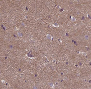 ANKRD26 Antibody - 1:100 staining human brain tissue by IHC-P. The tissue was formaldehyde fixed and a heat mediated antigen retrieval step in citrate buffer was performed. The tissue was then blocked and incubated with the antibody for 1.5 hours at 22°C. An HRP conjugated goat anti-rabbit antibody was used as the secondary.