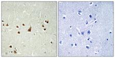 ANKRD26 Antibody - Peptide - + Immunohistochemistry analysis of paraffin-embedded human brain tissue using ANKRD26 antibody.