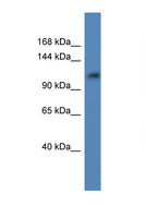 ANKRD27 Antibody - ANKRD27 antibody Western blot of MCF7 Cell lysate. Antibody concentration 1 ug/ml.  This image was taken for the unconjugated form of this product. Other forms have not been tested.