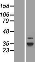 ANKRD29 Protein - Western validation with an anti-DDK antibody * L: Control HEK293 lysate R: Over-expression lysate