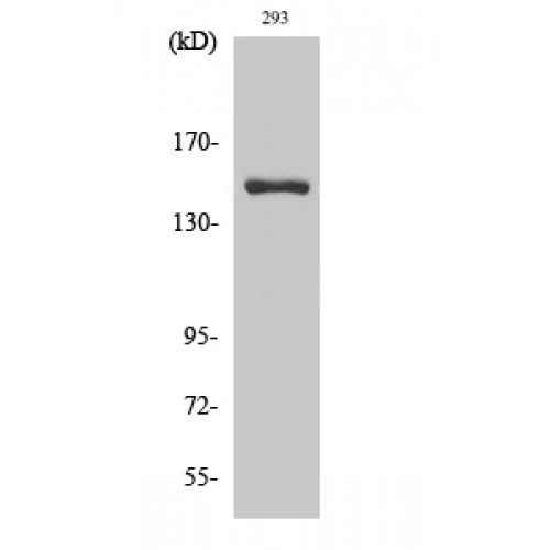 ANKRD30A / NY-BR-1 Antibody - Western blot of ANKRD30A antibody