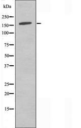 ANKRD30A / NY-BR-1 Antibody - Western blot analysis of extracts of COLO cells using AN30A antibody.