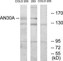 ANKRD30A / NY-BR-1 Antibody - Western blot analysis of extracts from COLO cells and 293 cells, using AN30A antibody.