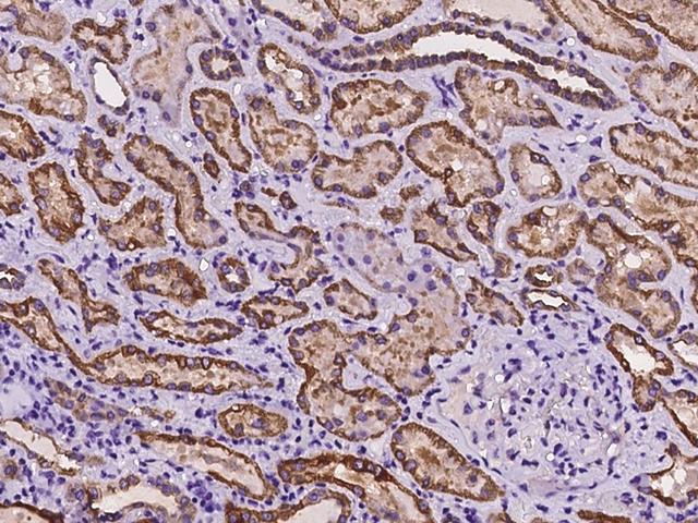 ANKRD30B Antibody - Immunochemical staining of human ANKRD30B in human kidney with rabbit polyclonal antibody at 1:1000 dilution, formalin-fixed paraffin embedded sections.