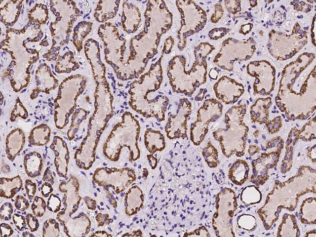 ANKRD33B Antibody - Immunochemical staining of human ANKRD33B in human kidney with rabbit polyclonal antibody at 1:100 dilution, formalin-fixed paraffin embedded sections.