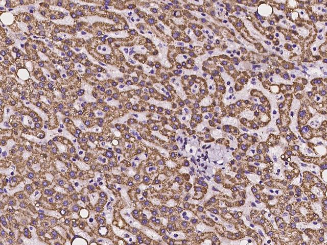 ANKRD33B Antibody - Immunochemical staining of human ANKRD33B in human liver with rabbit polyclonal antibody at 1:100 dilution, formalin-fixed paraffin embedded sections.