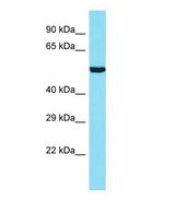 ANKRD34B Antibody - Western blot of ANKRD34B Antibody - N-terminal region with human 721_B cells lysate.  This image was taken for the unconjugated form of this product. Other forms have not been tested.