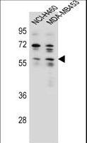 ANKRD34C Antibody - ANKRD34C Antibody western blot of NCI-H460,MDA-MB453 cell line lysates (35 ug/lane). The ANKRD34C antibody detected the ANKRD34C protein (arrow).