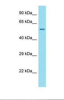 ANKRD34C Antibody - Western blot of Human OVCAR-3. ANKRD34C antibody dilution 1.0 ug/ml.  This image was taken for the unconjugated form of this product. Other forms have not been tested.