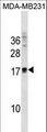 ANKRD37 Antibody - ANKRD37 Antibody western blot of MDA-MB231 cell line lysates (35 ug/lane). The ANKRD37 antibody detected the ANKRD37 protein (arrow).