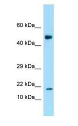 ANKRD37 Antibody - ANKRD37 antibody Western Blot of Mouse Spleen.  This image was taken for the unconjugated form of this product. Other forms have not been tested.