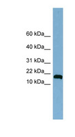 ANKRD37 Antibody - ANKRD37 antibody Western blot of Jurkat lysate. This image was taken for the unconjugated form of this product. Other forms have not been tested.