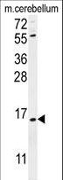 ANKRD39 Antibody - ANR39 Antibody western blot of mouse cerebellum tissue lysates (35 ug/lane). The ANR39 antibody detected the ANR39 protein (arrow).