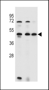 ANKRD40 Antibody - ANKRD40 Antibody western blot of 293,HL-60,MCF-7 cell line lysates (35 ug/lane). The ANKRD40 antibody detected the ANKRD40 protein (arrow).